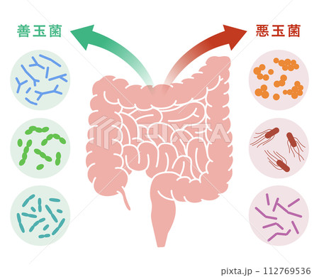 腸内細菌による医療イラスト　善玉菌　悪玉菌 112769536