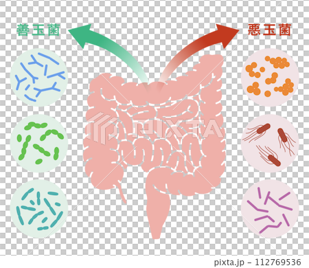 腸内細菌による医療イラスト　善玉菌　悪玉菌 112769536