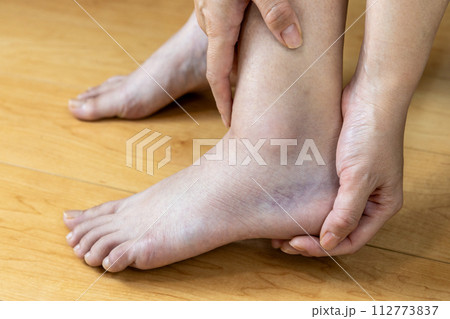 ねん挫した足首 112773837