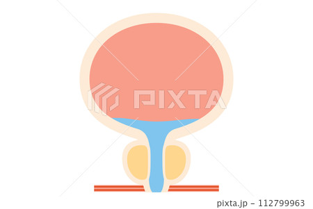 前立腺肥大症の医療イラスト、正常な前立腺 前立腺肥大症の医療イラスト、正常な前立腺 112799963