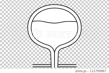 膀胱過動症的醫學插圖，這是一種正常膀胱儲存尿液的情況 112799967