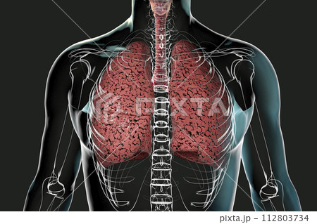Smoker's lungs, 3D illustration Smoker's lungs, 3D illustration 112803734