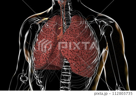 Smoker's lungs, 3D illustration Smoker's lungs, 3D illustration 112803735