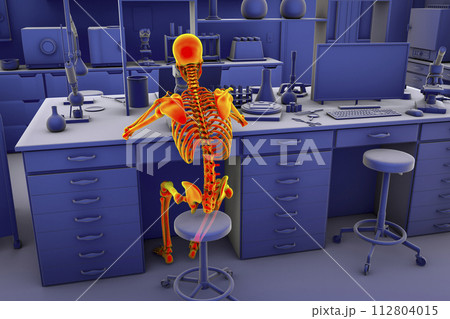 Work-related musculoskeletal disorders in laboratory workers, 3D illustration Work-related musculoskeletal disorders in laboratory workers, 3D illustration 112804015