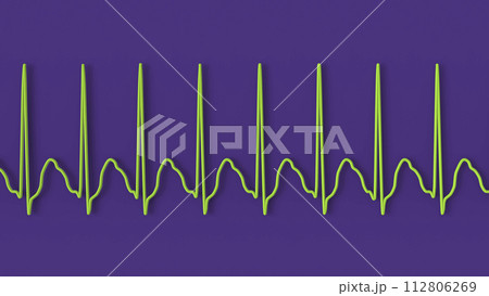 ECG in atrial flutter, 3D illustration 112806269