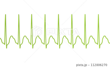 ECG in atrial flutter, 3D illustration ECG in atrial flutter, 3D illustration 112806270