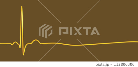 ECG in asystole, 3D illustrationのイラスト素材 [112806306] - PIXTA