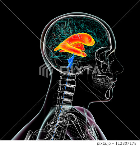 Enlarged lateral and third ventricles of the brain, 3D illustration 112807178