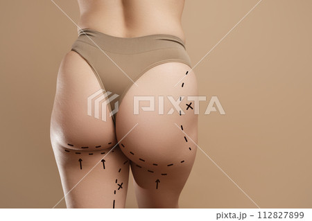 Female body with the drawing arrows. Buttocks, hip 112827899