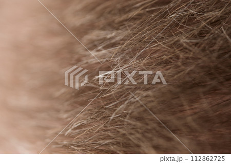 Macro shot of hair loss problem of blonde man hair closeup 112862725