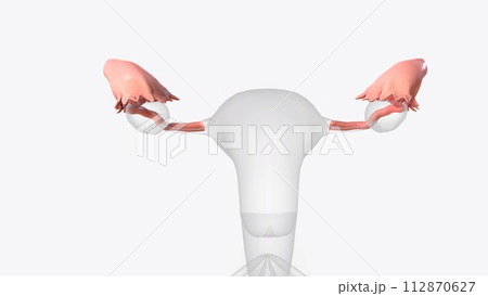 The fallopian tubes are bilateral conduits between the ovaries and the uterus in the female pelvis 112870627