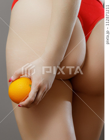 Stretch marks on female legs. A woman's hand holds Stretch marks on female legs. A woman's hand holds 112871211