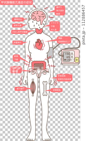 甲状腺機能亢進症の症状 112886457