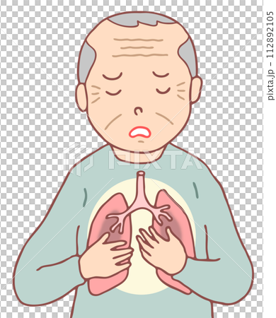 Illness/Disease - Pneumonia, Elderly Diseases, Decreased Immunity, Decreased Resistance 112892105