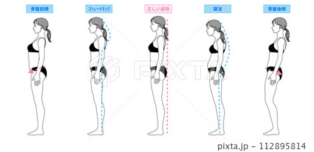 姿勢改善 姿勢矯正 猫背 ストレートネック 骨盤後傾 骨盤前傾の女性のイラスト 全身横向き 112895814