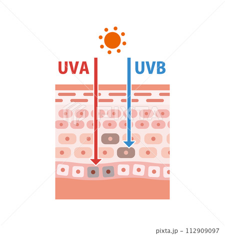日焼けの仕組みを解説する紫外線と肌の構造の図解。フラットなベクターイラスト。 112909097