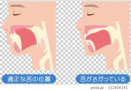 Correct and lowered tongue position - Mewing 112916141
