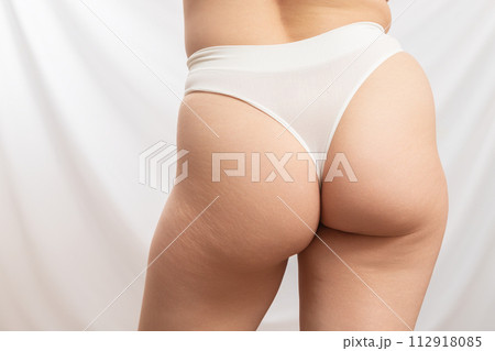 Real Natural human skin . No retouch . body 112918085