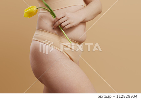 Body imperfections. Real human skin without Body imperfections. Real human skin without 112928934