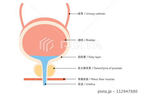 前立腺の医療イラスト、前立腺と膀胱 112947880