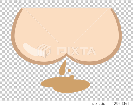 お尻と下痢のイラスト お尻と下痢のイラスト 112953361