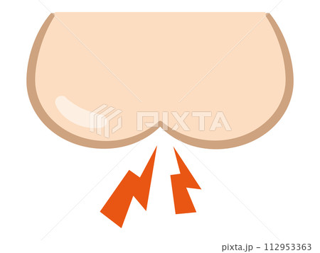 おしりがヒリヒリするイラスト 112953363