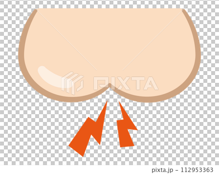 おしりがヒリヒリするイラスト 112953363