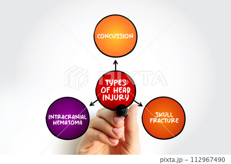Different types of head injury, mind map text concept for presentations and reports Different types of head injury, mind map text concept for presentations and reports 112967490
