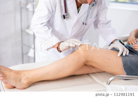 Attentive doctor man examining the sore knee of female patient 112981191