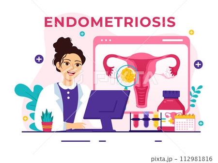 Endometriosis Vector Illustration with Condition the Endometrium Grows Outside the Uterine Wall in Women for Treatment in Flat Cartoon Background Endometriosis Vector Illustration with Condition the Endometrium Grows Outside the Uterine Wall in Women for Treatment in Flat Cartoon Background 112981816
