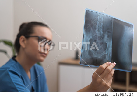 doctor in blue scrubs uniform close up hand holding X-ray film to diagnose healthcare in the hospital.  112994324