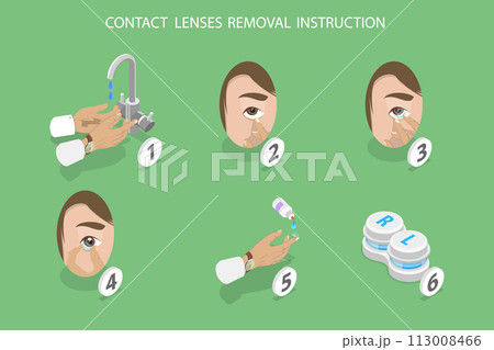 3D Isometric Flat Vector Illustration of Contact Lenses Removal Instruction, Ophtalmology and Eye Care 3D Isometric Flat Vector Illustration of Contact Lenses Removal Instruction, Ophtalmology and Eye Care 113008466