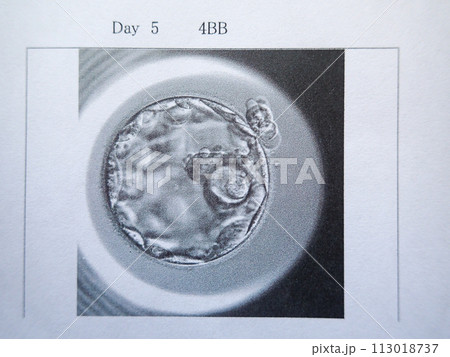 凍結した胚盤胞 凍結した胚盤胞 113018737
