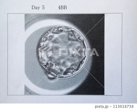 4BBの胚盤胞 113018738