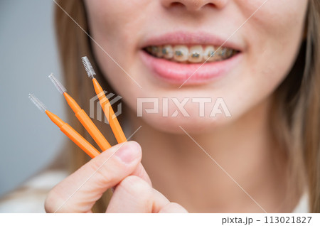 Close-up portrait of a woman with braces holding a floss to clean her teeth.  113021827