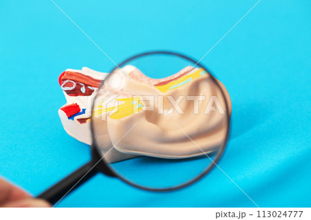Medical ear mockup on a blue background under a magnifying glass. Concept of tympanic cavity shunting and laser tympanometry, acoustic neuritis 113024777