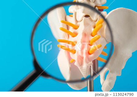 Coccyx and sacrum of the spine mockup on a blue background under a magnifying glass. Concept of degenerative spine diseases, injuries and back pain. Lordosis and lumbago, close-up 113024790
