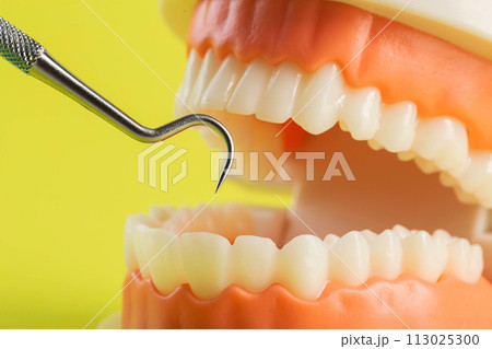 dental instrument on a yellow background near a dental jaw mockup. The concept of disease and dental treatment in dentistry. Periodontitis and gingivitis of the oral cavity. Pulpitis and caries, dental instrument on a yellow background near a dental jaw mockup. The concept of disease and dental treatment in dentistry. Periodontitis and gingivitis of the oral cavity. Pulpitis and caries, 113025300