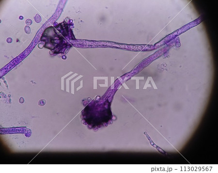 カビの胞子の顕微鏡観察 カビの胞子の顕微鏡観察 113029567