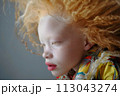 Close Up of Child With Red Hair.June 13, International Albinism Awareness Day 113043274