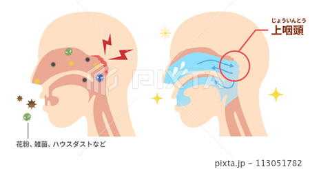 鼻うがいの効果とやり方　上咽頭を洗浄する方法 113051782