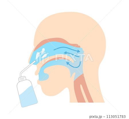 横から見た鼻うがいの効果とやり方と図解 113051783