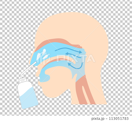横から見た鼻うがいの効果とやり方と図解 113051783