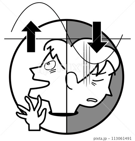 双極性障害-気分が落ち込んだり舞い上がったり不安定 113061491