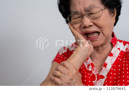 Asia old senior woman suffering from severe toothache, holding her cheek and suffering strong dental pain on white background, tooth decay, tooth sensitivity, oral health care concept. Asia old senior woman suffering from severe toothache, holding her cheek and suffering strong dental pain on white background, tooth decay, tooth sensitivity, oral health care concept. 113079641