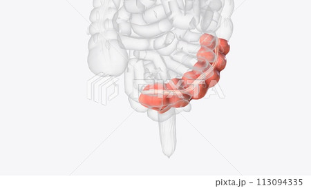 he sigmoid colon is the last part of the colon and connects to the rectum 113094335