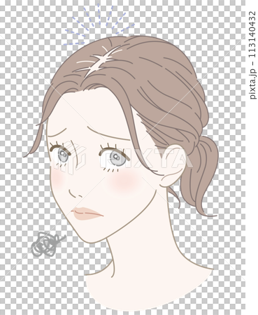 女性　薄毛　悩み　イラスト 113140432