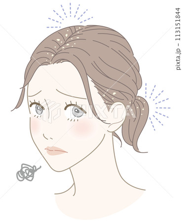女性　フケ　悩み　イラスト 113151844