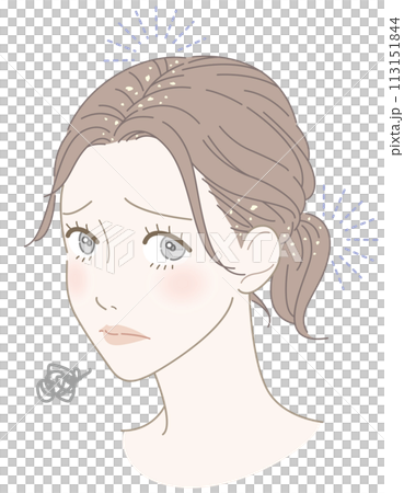女性　フケ　悩み　イラスト 113151844
