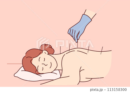 Acupuncture procedure from traditional chinese medicine for woman lying at reception in SPA center 113158300